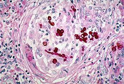 Wangiella dermatitidis под действием радиационного излучения